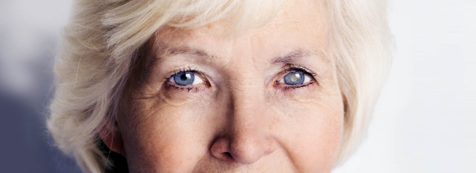 Cataract Surgery in Spring
